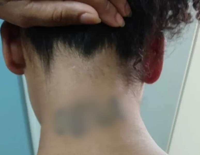 De acordo com a polícia, a vítima disse que o companheiro a obrigava a fazer tatuagens com o nome e apelido dele pelo corpo.