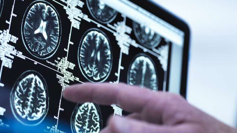 M&eacute;dico analisa resson&acirc;ncia cerebral