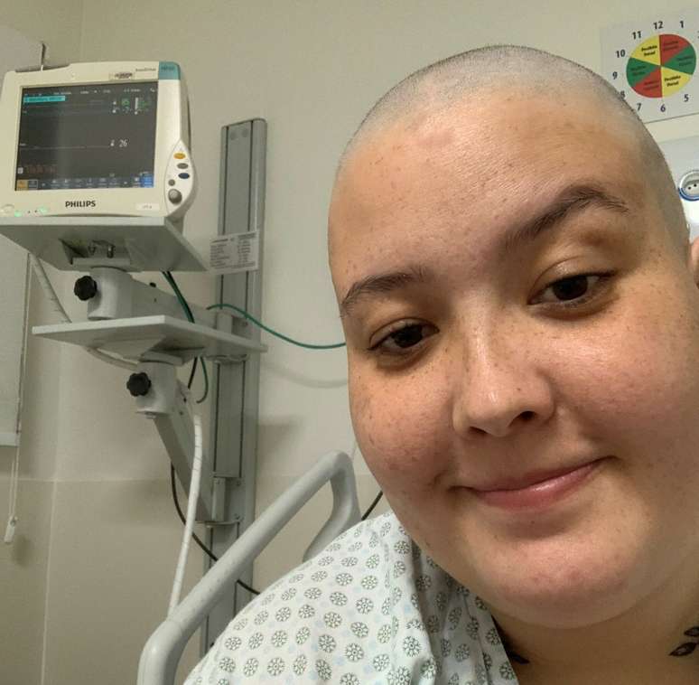 Carolina relata como a perda de cabelo afetou seu emocional @Arquivo Pessoal