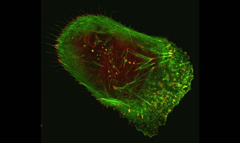 Célula de melanoma humano vista em microscópio confocal fluorescente de varredura a laser