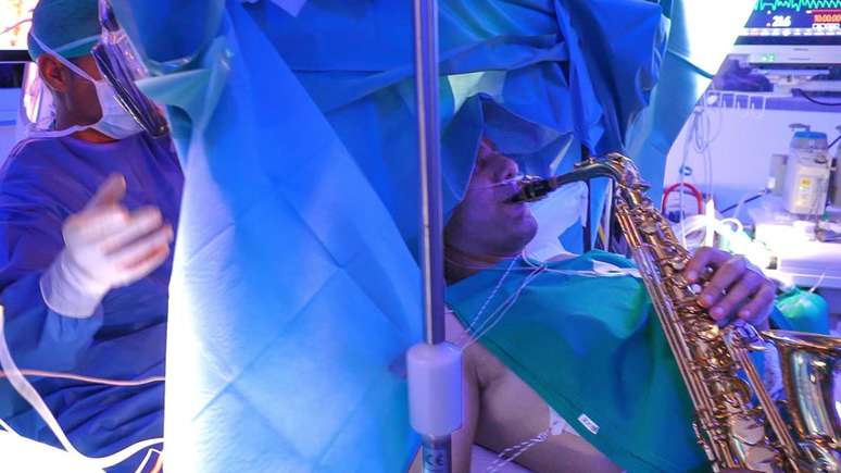 Na Itália, paciente toca saxofone durante cirurgia no cérebro