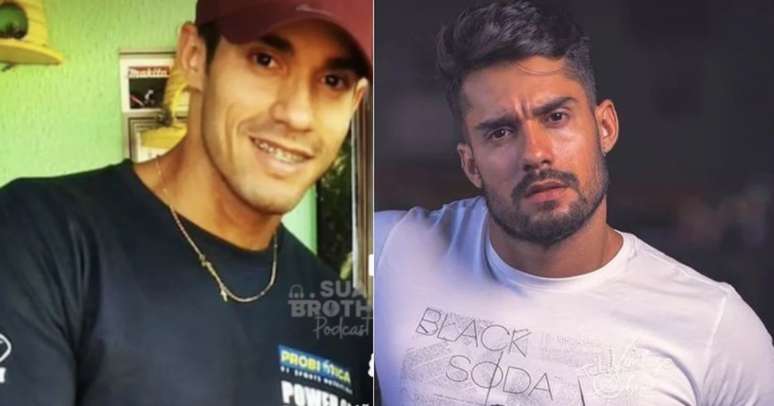 Bill Araújo, antes e depois dos procedimentos