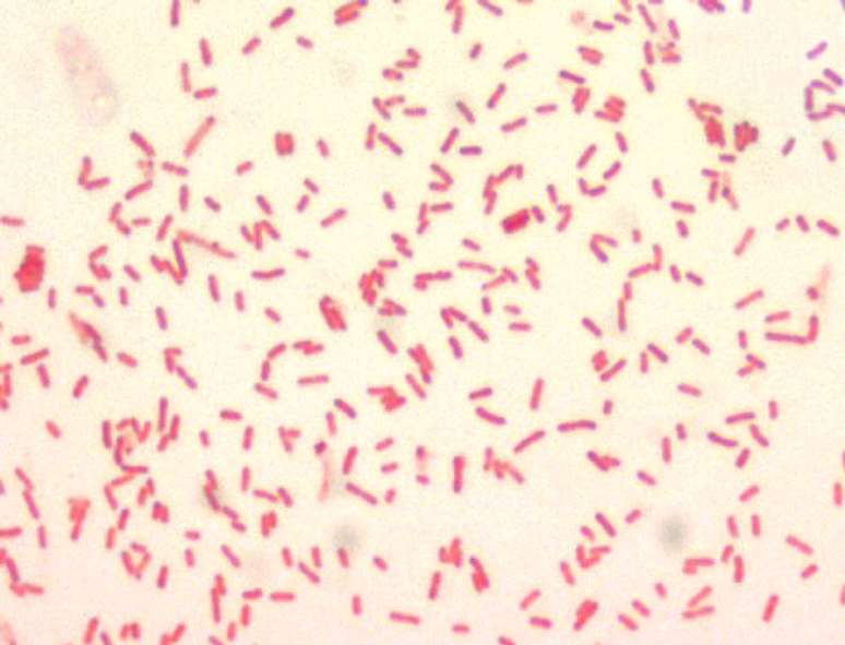 Como a peste negra ainda afeta nossa resposta a doenças autoimunes