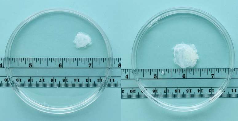 Tecido removido na sexta (esquerda) e na s&eacute;tima (direita) semana de gesta&ccedil;&atilde;o