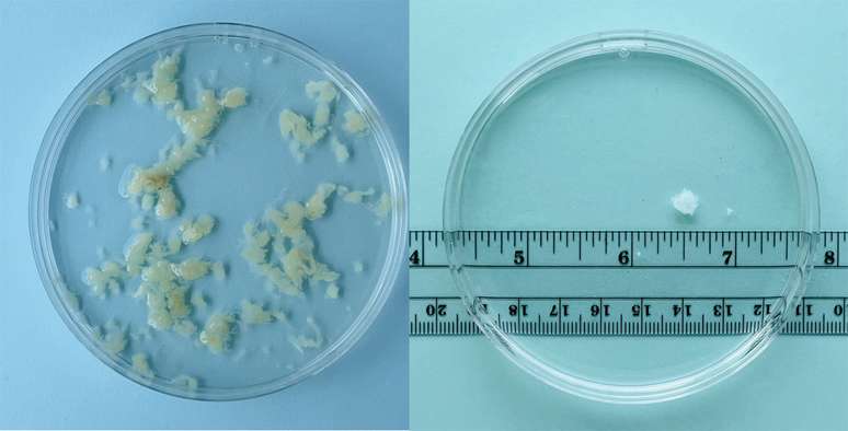 Tecido removido na quarta (esquerda) e na quinta (direita) semana de gesta&ccedil;&atilde;o