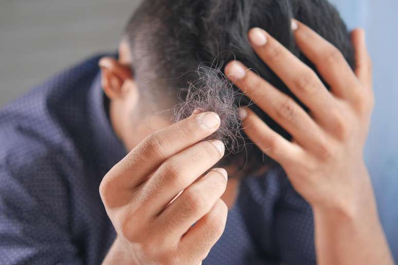 A queda de cabelo também está entre os mais de 60 sintomas persistentes associados com frequência à covid longa