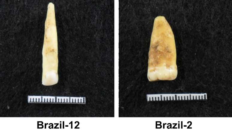 Dentes tendem a ter melhor preservação do que os ossos, explica cientista