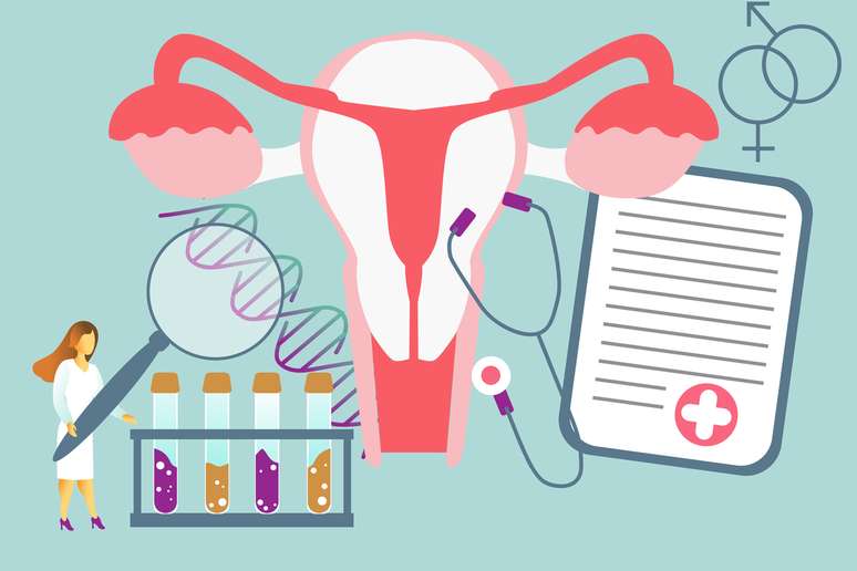 O tipo de tratamento para a endometriose varia de acordo aspectos da paciente 