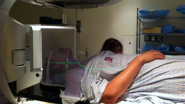 O tratamento de Sarah McDonald inclui quimio e radioterapia simultâneas