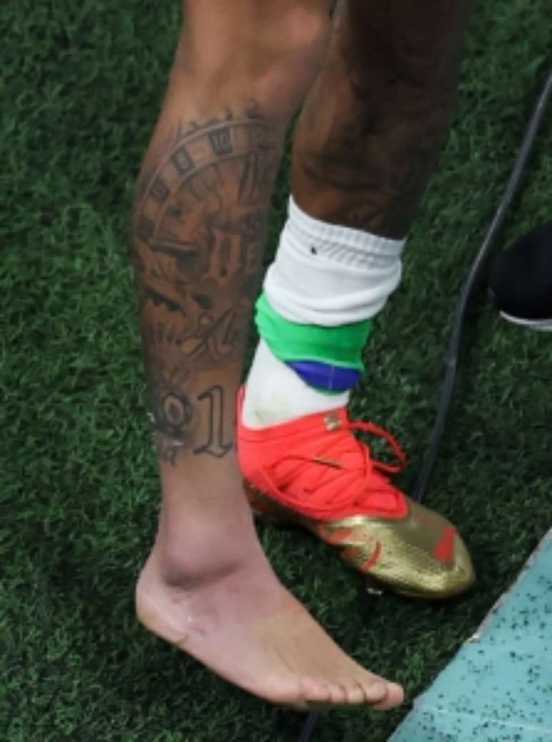 Tornozelo de Neymar após a vitória do Brasil (Foto: GIUSEPPE CACACE / AFP)