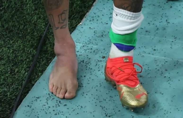 Tornozelo de Neymar ficou muito inchado após lesão (Foto: GIUSEPPE CACACE / AFP)
