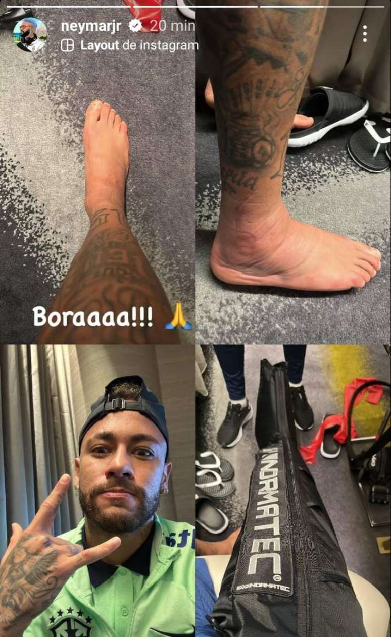 Neymar exibe pé machucado nas redes sociais, mas mostra animação em tratamento.