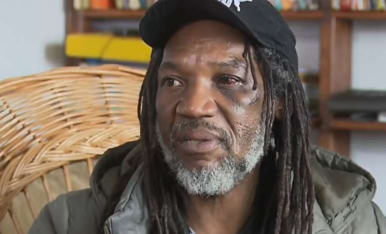 Neno ficou com ferimentos no rosto, nos bra&ccedil;os e nas costas