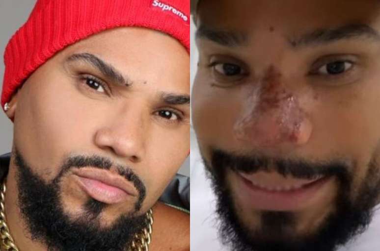 Naldo Benny, antes e depois