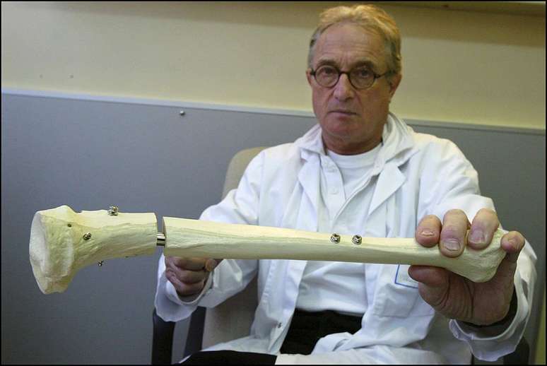 A cirurgia consiste em quebrar o osso e separ&aacute;-lo sutilmente com o aux&iacute;lio de uma barra