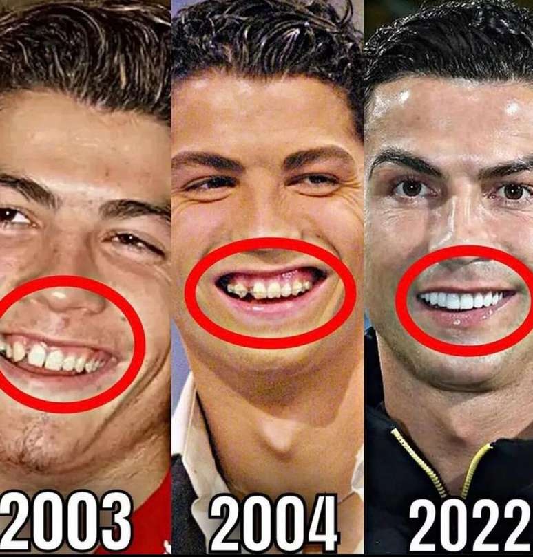 Muita gente não se lembra de como o futebolista transformou o sorriso ao longo dos anos.