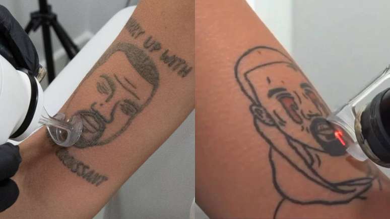 Naama, estúdio em Londres, diz que vai remover tatuagens inspiradas em Kanye West de graça.