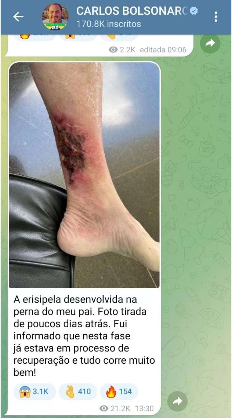 Post de Carlos Bolsonaro no Telegram