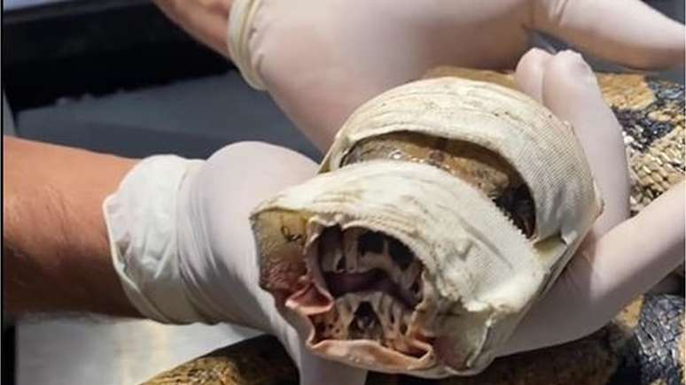 Alimenta&ccedil;&atilde;o de Santinha era feita periodicamente a partir da inser&ccedil;&atilde;o de uma sonda at&eacute; cavidade estomacal