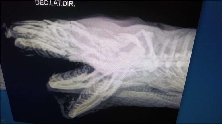 Raio-x mostra fratura na mand&iacute;bula de Santinha