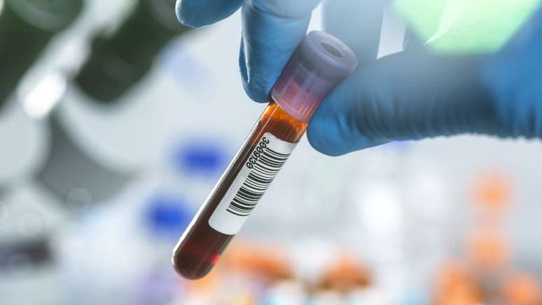 Toda mulher deve saber qual seu fator RH e o do seu parceiro antes de engravidar