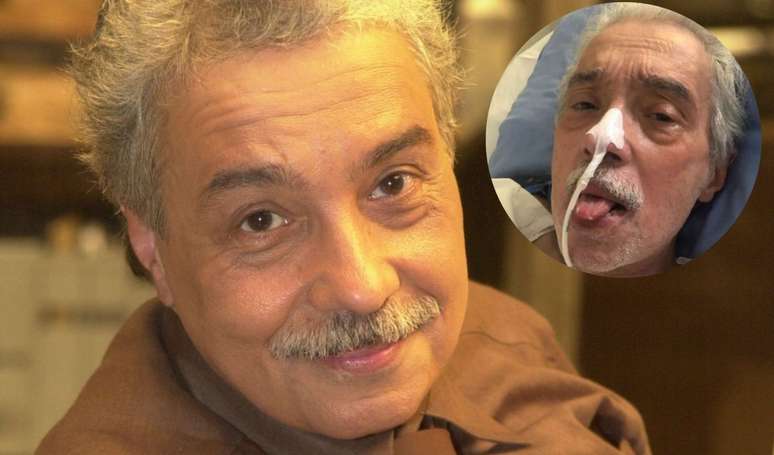 Internado para tratar de DPOC, doença pulmonar obstrutiva crônica, Pedro Paulo Rangel precisou ser intubado.