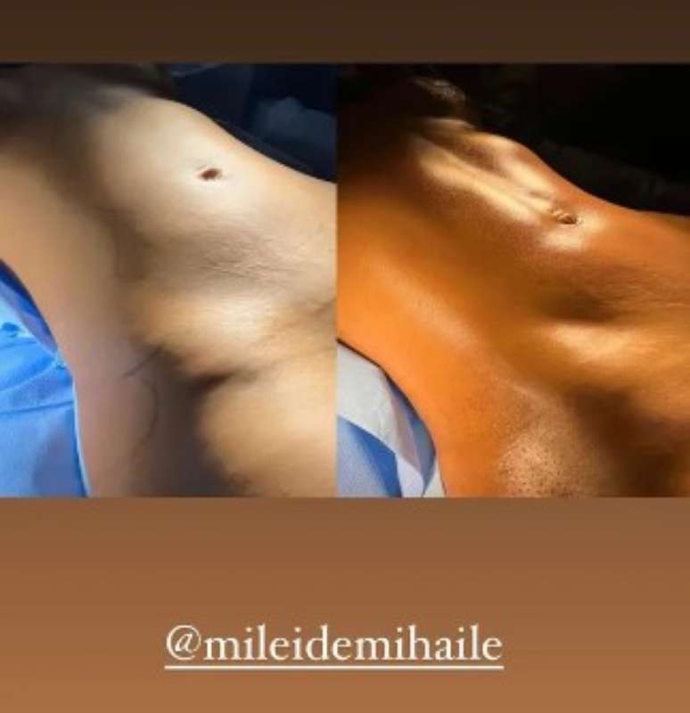 Mileide Mihaile, antes e depois