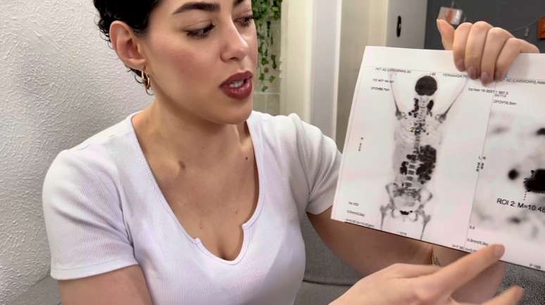 Por meio de um exame de imagem, Fernanda descobriu a gravidade da condi&ccedil;&atilde;o