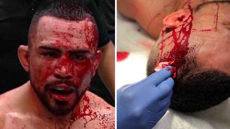 O lutador Rafa Garcia ficou banhado em sangue após uma cotovelada em sua cabeça durante a luta contra Maheshate no sábado, 17