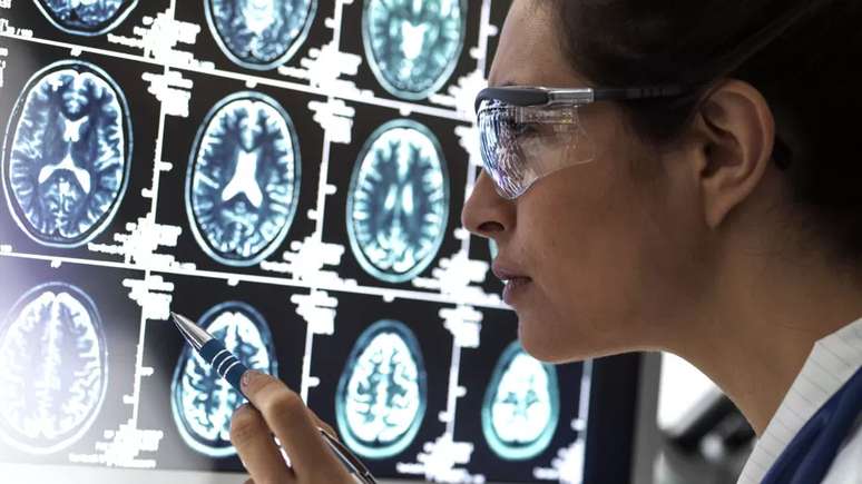 A pesquisa de Alzheimer entrar&aacute; em um est&aacute;gio de desenvolvimento de drogas