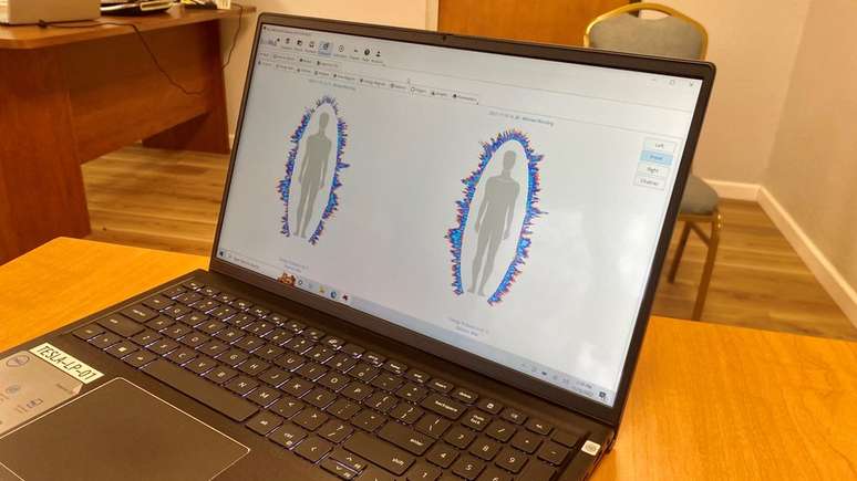 O laptop da m&eacute;dica mostra supostos n&iacute;veis de energia antes e depois do uso da MedBed