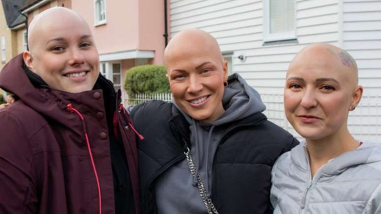 Laura Mathias fez amizade com outras mulheres jovens com alopecia, que ela conheceu nas redes sociais.