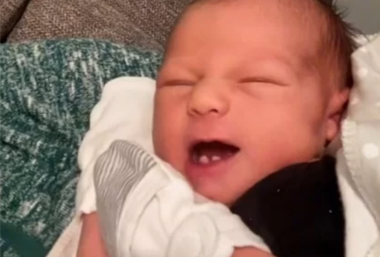 Bebê nasce com três dentes na Austrália