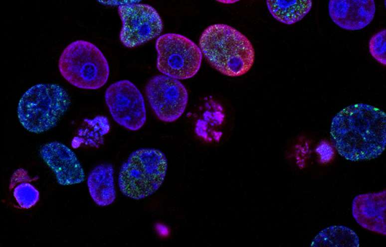 Cientistas rastrearam proteínas que ajuda câncer a se espalhar