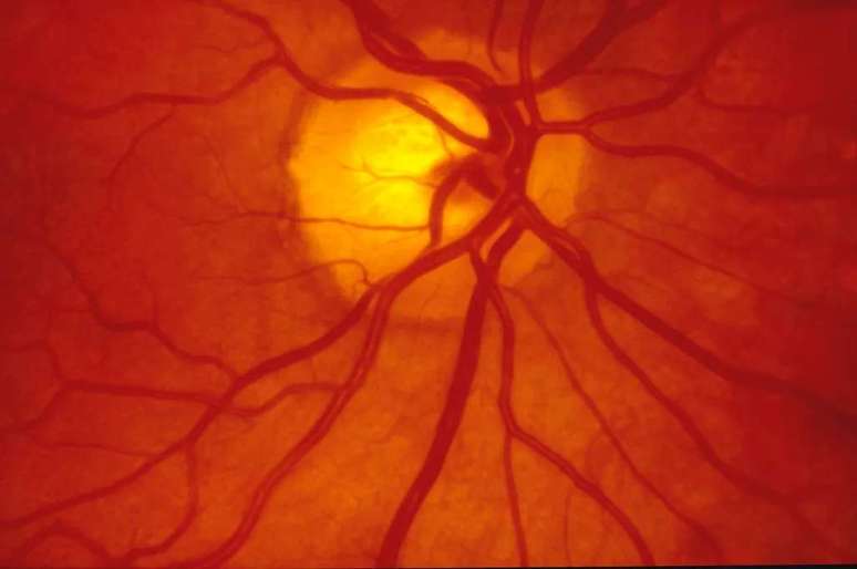 Células cultivadas em laboratório estão cada vez mais perto de serem usadas para substituir a retina danificada de pacientes oculares (Imagem: Twenty20photos/Envato Elements)