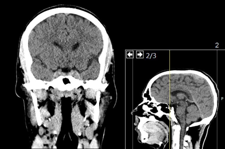 C&eacute;rebro tende a guardar mem&oacute;rias emocionais com mais facilidade