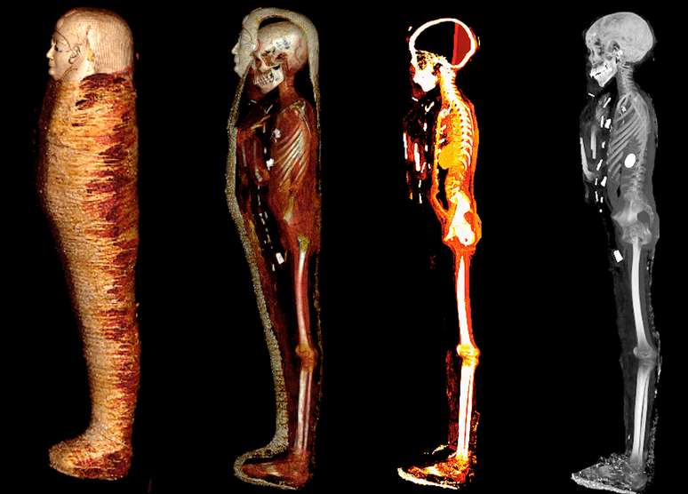 Múmia foi dividida digitalmente em quatro etapas