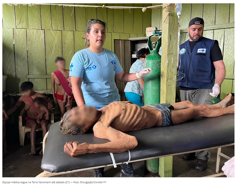 Print do G1 mostra que foto de indígena em maca foi divulgada pelo Condisi-YY.