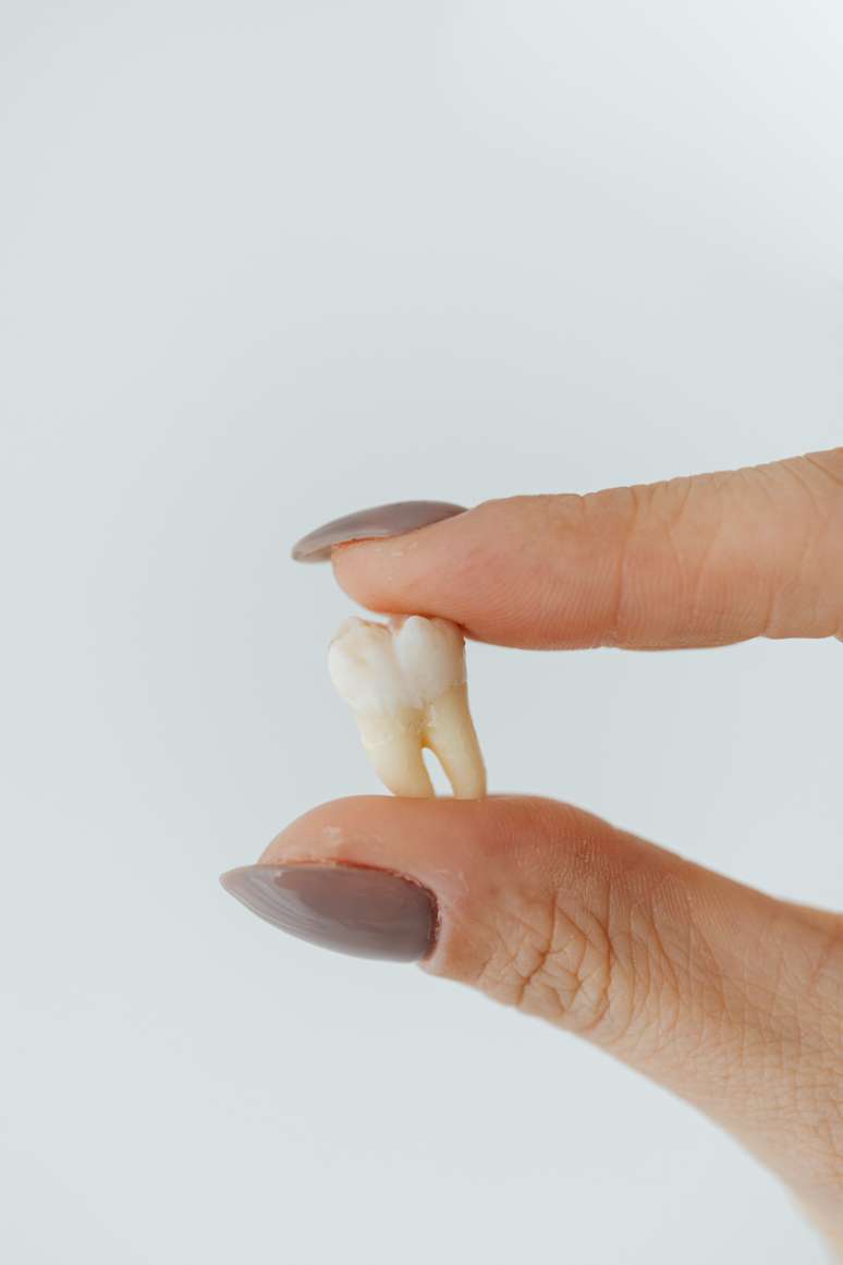 Um adulto com uma dentição permanente completa (com os sisos) costuma ter na boca 32 dentes