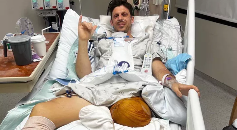 Papá perdió ambas piernas al salvar a sus hijas en California