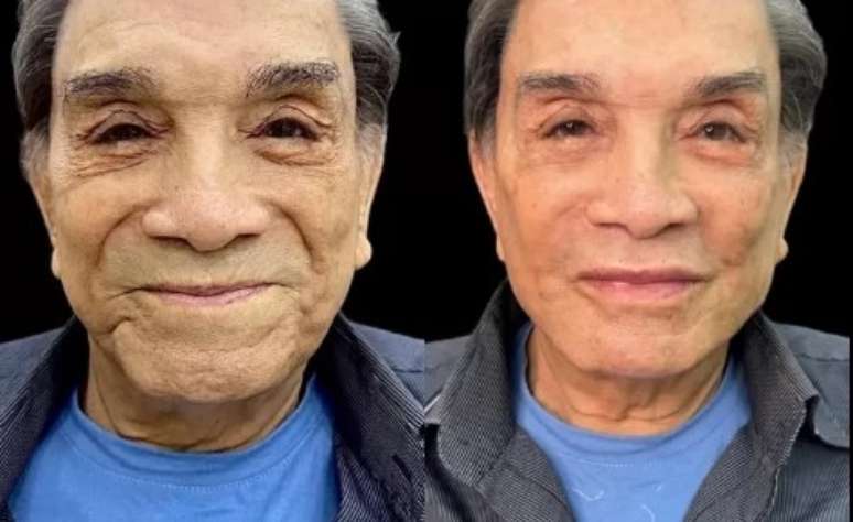 Antes e depois: Dedé Santana