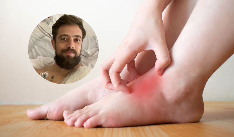 Infectious cellulitis: find out what is the disease that caused the hospitalization of the actor Rafael Cardoso