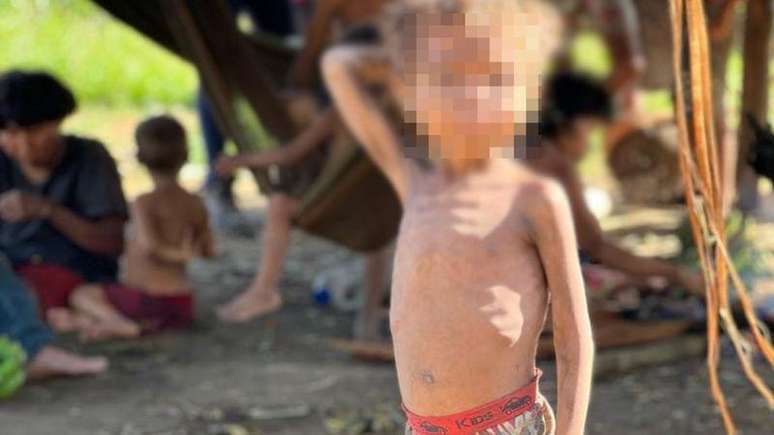 'A desnutrição que a gente observa entre eles é pela escassez de alimento'