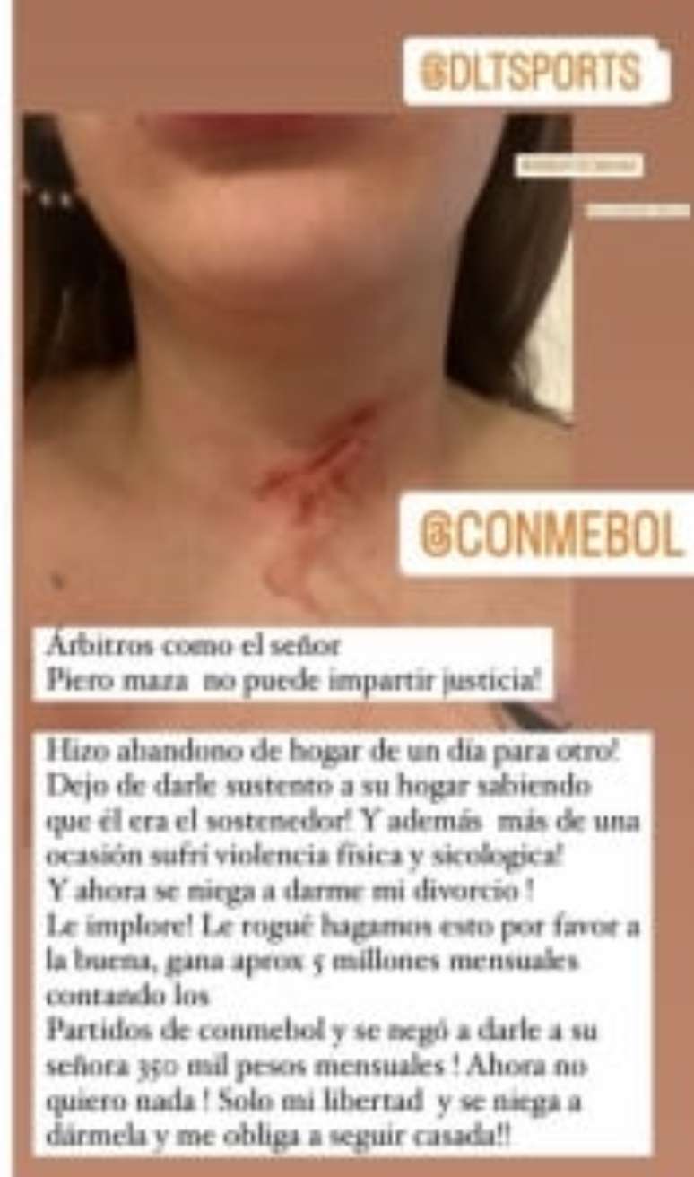 Pollet publicou imagem de agressão de Piero Maza nas redes sociais (Foto: Reprodução/Instagram)