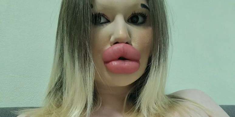 Andrea Ivanova é a "mulher com os maiores lábios do mundo"