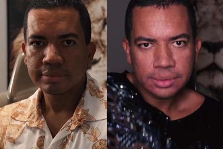 Bruno Gaga, antes e depois