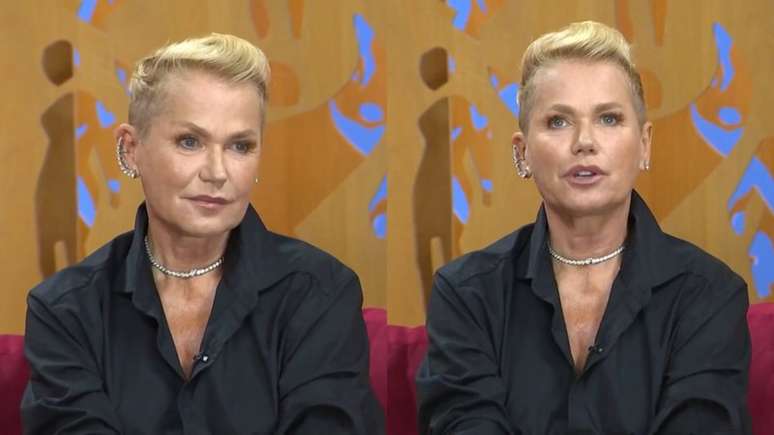 Xuxa abre o jogo sobre paralisia que sofreu com cirurgia plástica