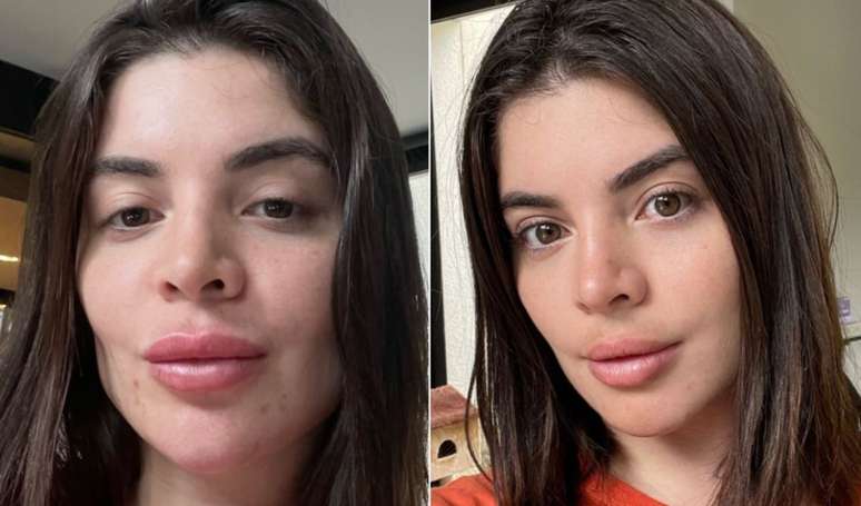 Gkay has spent an astonishing amount on cosmetic procedures.  See the details!