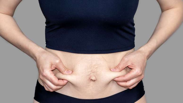 A diástase abdominal provoca uma série de alterações gastrointestinais -