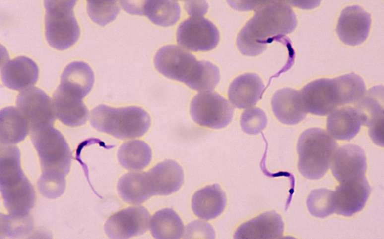 At&eacute; 4,6 milh&otilde;es de brasileiros est&atilde;o infectados com o Trypanosoma cruzi, que s&atilde;o os filamentos roxos vistos nesta imagem de microsc&oacute;pio